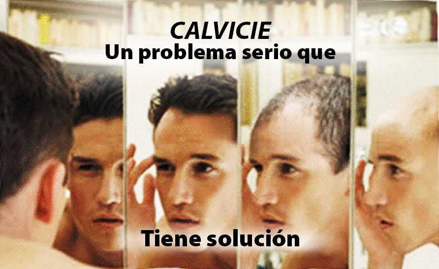 Calvicie en Guayaquil